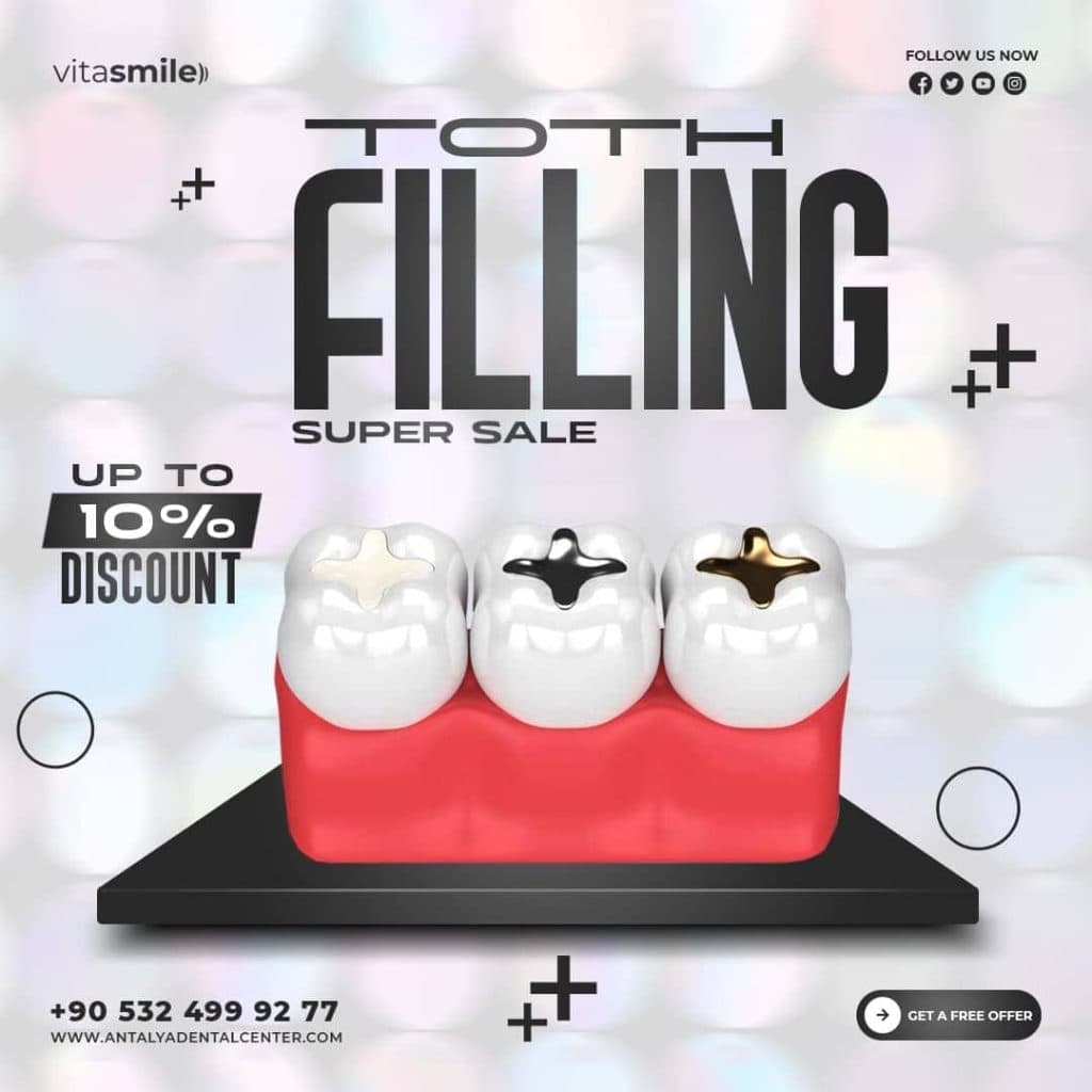 tooth filling discount offer